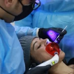 How to Deal with Severely Infected Teeth